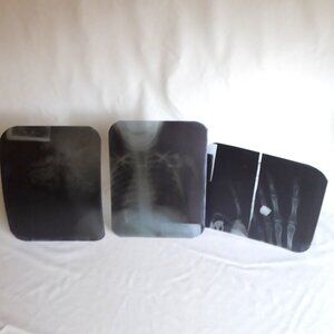 VINTAGE X-RAY FILM CHEST NECK HEAD FINGERS WITH RING LOT OF 3 ODDITY CURIOSITIES